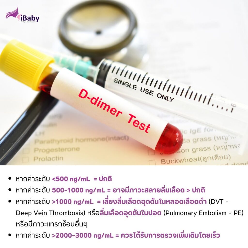 ระดับ D-dimer