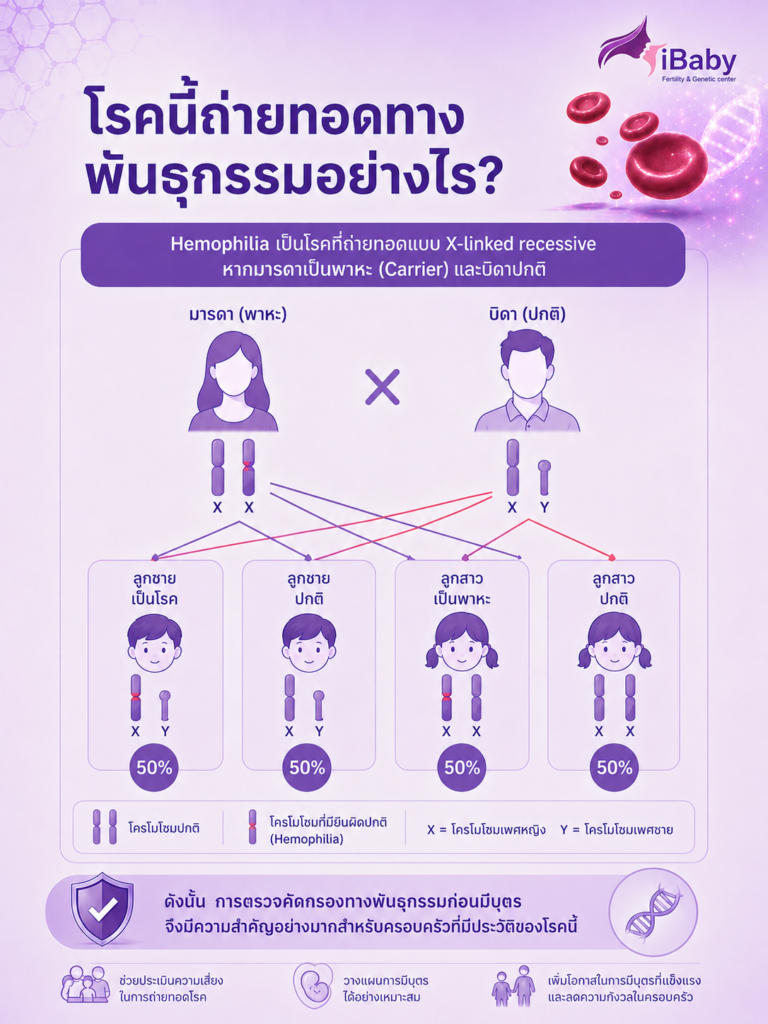 โรคเลือดออกง่ายหยุดยาก
ฮีโมฟีเลีย Hemophilia
