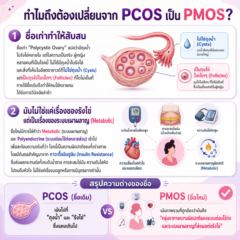 PMOS คืออะไร