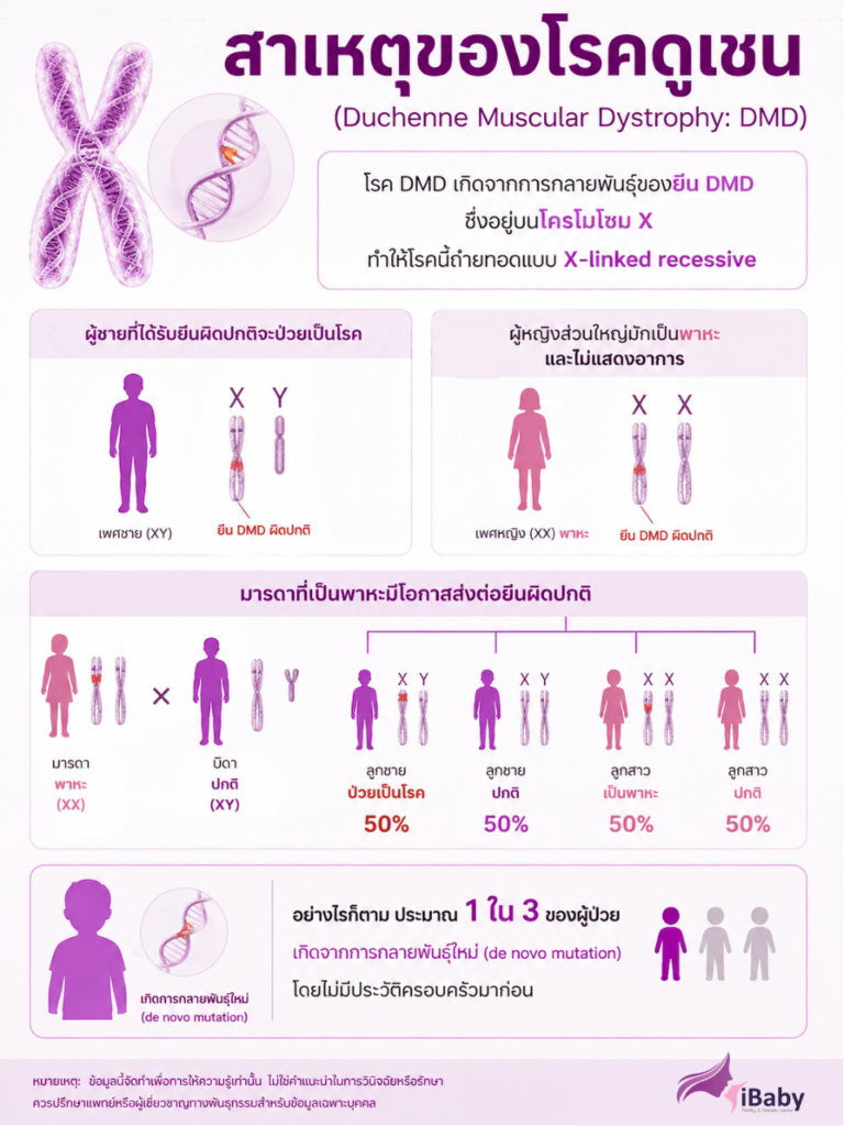โรคดูเชน กล้ามเนื้อเสื่อมทางพันธุกรรม วิธีรักษาโรคดูเชน ตรวจพาหะโรคกล้ามเนื้อเสื่อม PGT-M โรคทางพันธุกรรม
